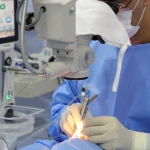 cirurgia de córnea